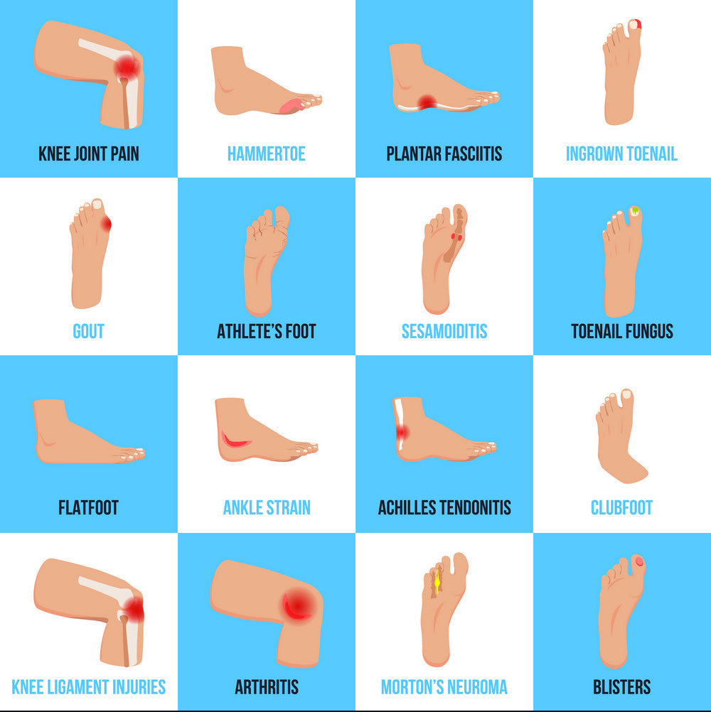 5 Common Foot Problems: Causes, Symptoms, and Treatment