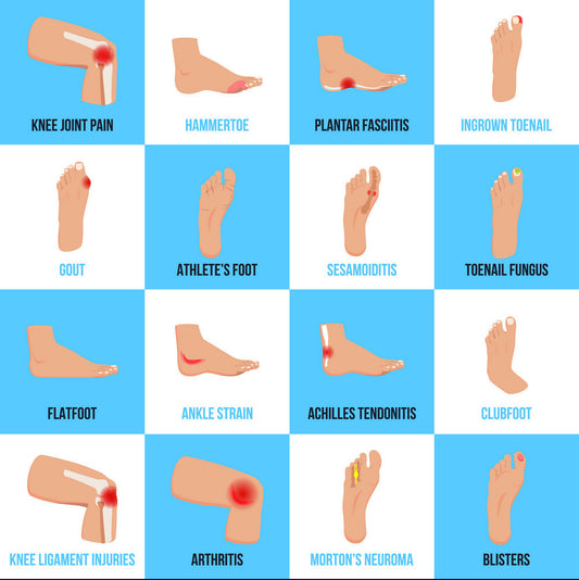 5 Common Foot Problems: Causes, Symptoms, and Treatment