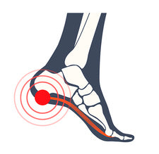 Why Does Your Heel Hurt?