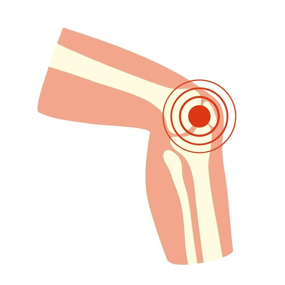 Managing Arthritis Pain