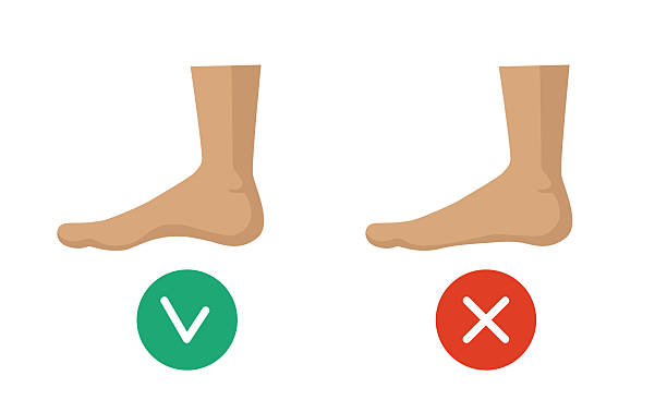 Flat Feet Explained Simply